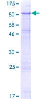 Human UMOD / Uromodulin Protein (Recombinant GST)