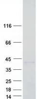 Human LGALS9 / Galectin 9 Protein (Recombinant Myc-DDK (Flag))