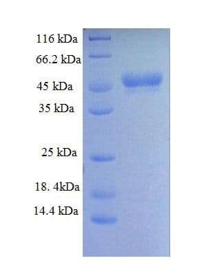 Human HDAC4 Protein (Recombinant GST, N-terminus)
