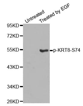 KRT8 / CK8 / Cytokeratin 8 Antibody (phospho-Ser74)