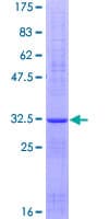 Human PART1 Protein (Recombinant GST)