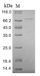 Human XRCC5 / Ku80 Protein (Recombinant MBP, N-terminus + 6His, C-terminus)