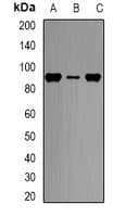 Polyclonal Rabbit anti-Human CPT1A Antibody (IF, WB)