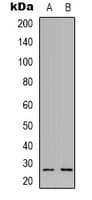 NXPH3 / Neurexophilin 3 Antibody (Internal)