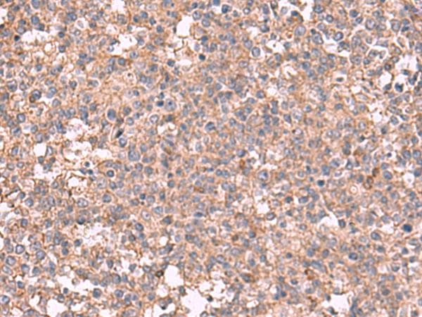 Polyclonal Rabbit anti-Human MAPK8IP3 / JIP3 Antibody (IHC)