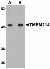 TMEM214 / FLJ20254 Antibody