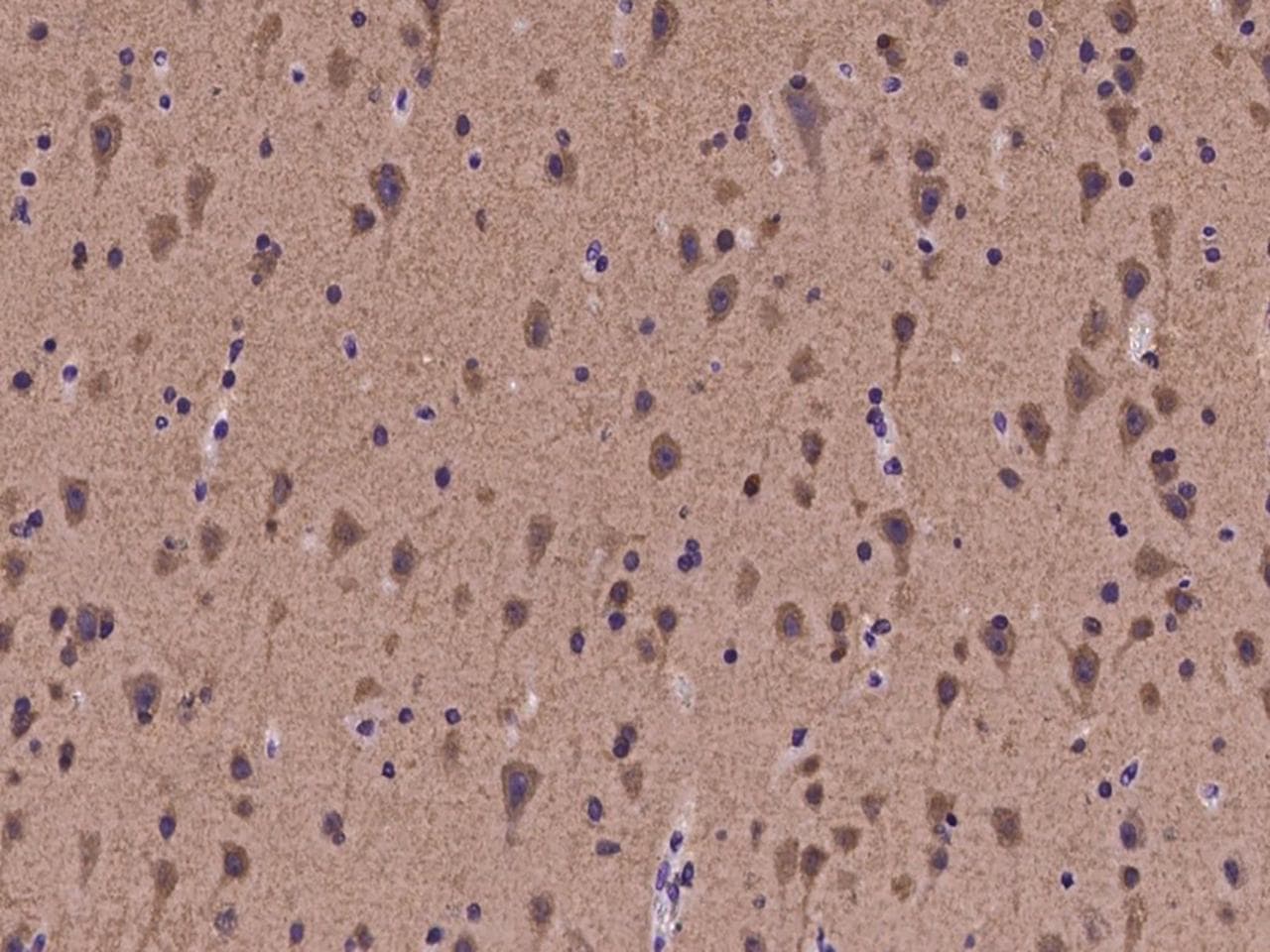 DGKZ Antibody