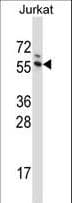 G3BP1 / G3BP Antibody (aa401-430)