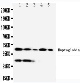 Polyclonal Rabbit anti-Human HP / Haptoglobin Antibody (aa294-309, IHC, WB)