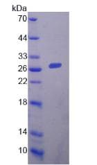 Mouse TMEM173 / STING Protein (Recombinant His, N-Terminal)