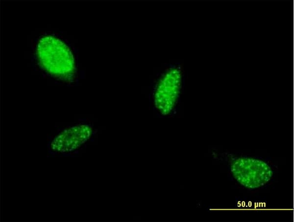 ATOH1 / MATH-1 Antibody (clone 1B12)