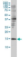 GMF Beta / GMFB Antibody (clone 2G12-2A2)