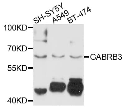 GABRB3 Antibody