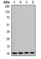Polyclonal Rabbit anti-Human GABARAPL1 / ATG8 Antibody (WB)