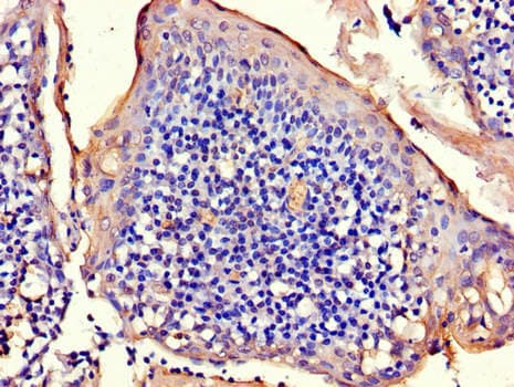 RAD54B Antibody