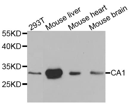 Polyclonal Rabbit anti-Human CA1 / Carbonic Anhydrase I Antibody (IHC, IF, WB)