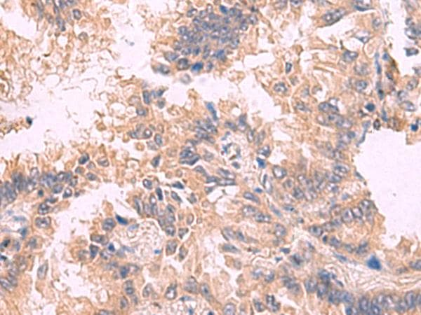 TJP1 / ZO-1 Antibody