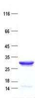 Human GSTT1 Protein (Recombinant His, N-Terminal)