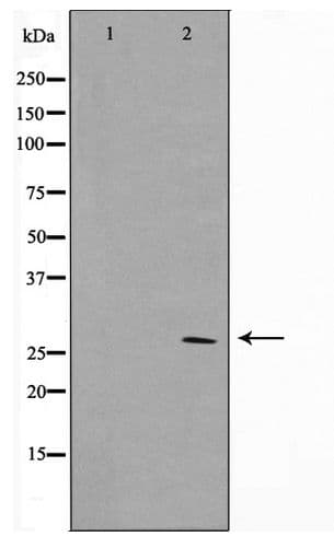SIX6 Antibody