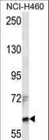 ZFX Antibody (aa288-317)