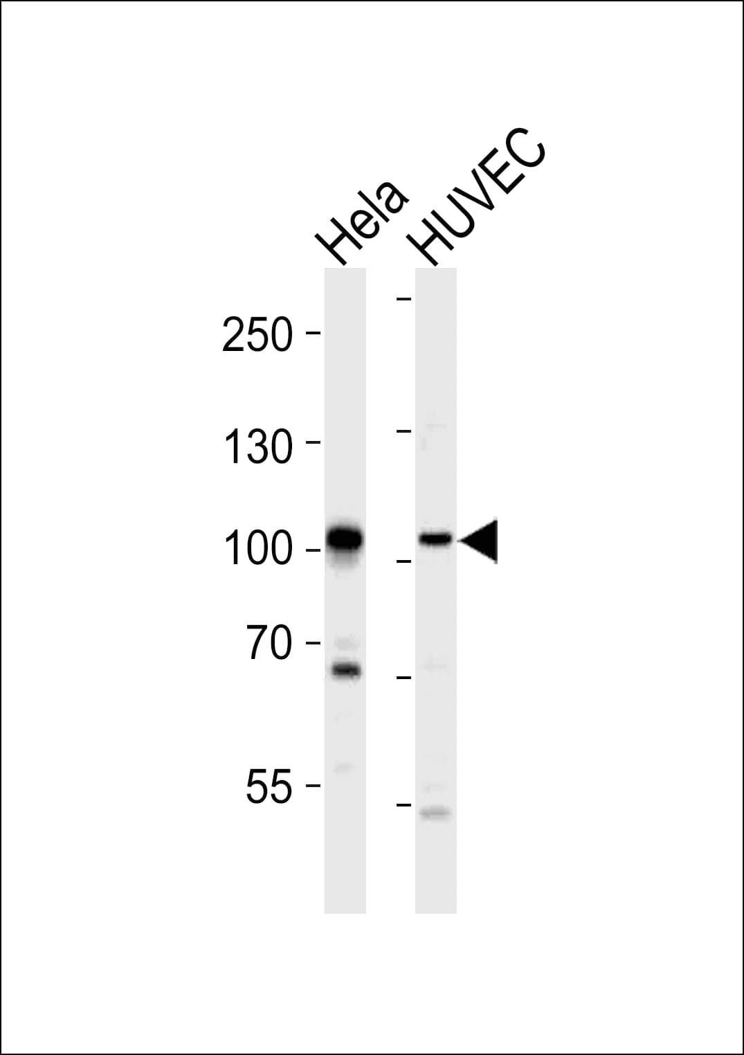 Polyclonal Rabbit anti-Human EPHA4 / EPH Receptor A4 Antibody (aa875-904, IHC, WB)
