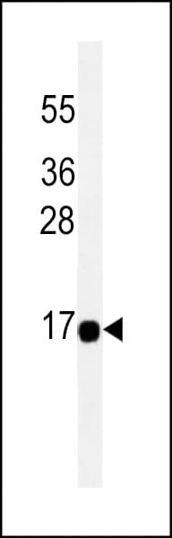 ACOT13 / THEM2 Antibody