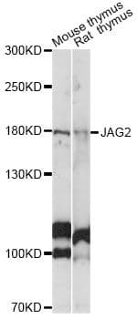 Polyclonal Rabbit anti-Human JAG2 / Jagged-2 Antibody (WB)