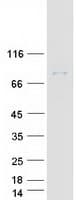 Human ZER1 Protein (Recombinant Myc-DDK (Flag))