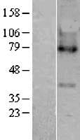 Human MBOAT5 / C3F Protein (Over-Expression Lysate Myc-DDK (Flag))