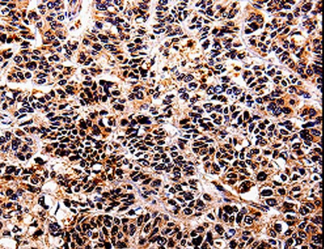 Polyclonal Rabbit anti-Human IL10RA Antibody (IHC)