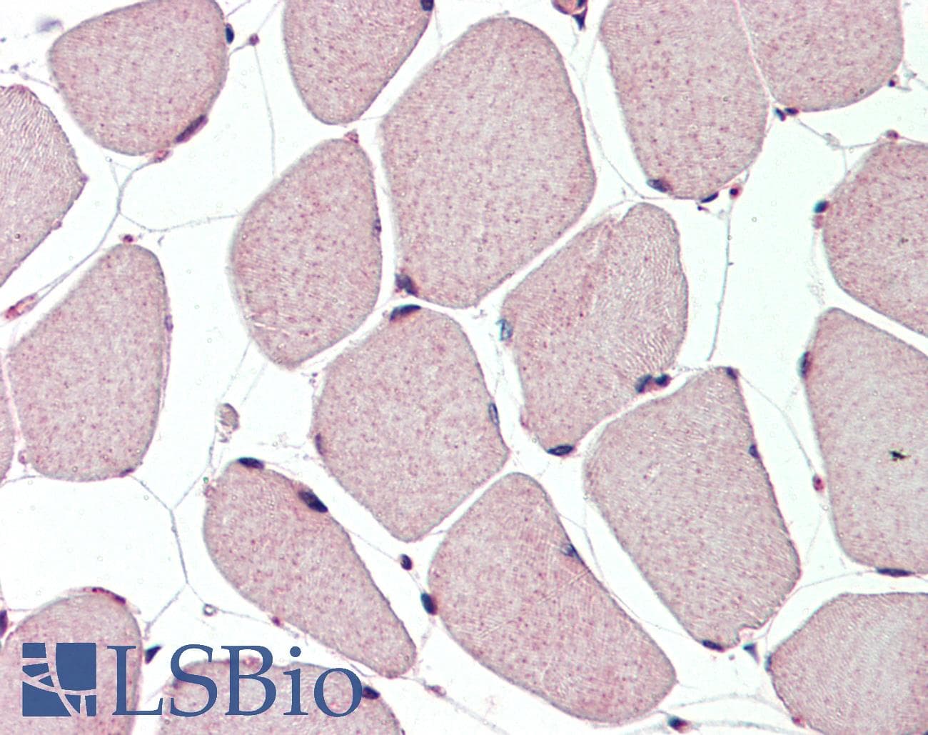 TFAP2B / AP2 Beta Antibody (N-Terminus)