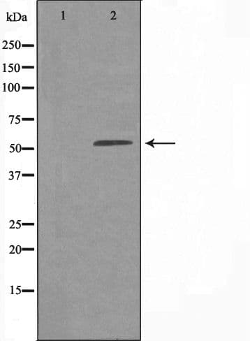 Polyclonal Rabbit anti-Human EIF2B4 Antibody (IF, WB)