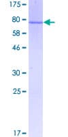 Human WARS Protein (Recombinant GST)