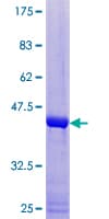 Human HSPB6 / HSP20 Protein (Recombinant GST)