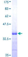 Human TNFRSF10A / DR4 Protein (Recombinant GST, N-terminus)