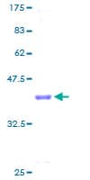 Human CYCS / Cytochrome c Protein (Recombinant GST)