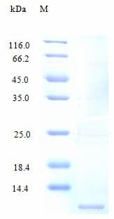 Human CCL4 / MIP-1 Beta Protein (Recombinant)