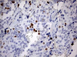 Monoclonal Mouse anti-Human MKI67 / Ki67 Antibody (clone OTI1F11, Carrier-free, aa1160-1493, IHC, WB)