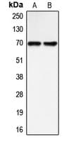 Polyclonal Rabbit anti-Human BLNK Antibody (Internal, IHC, WB)