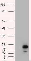 RAB17 Antibody (clone OTI5E2)
