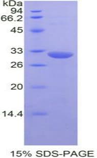 Mouse MAPK8 / JNK1 Protein (Recombinant His-T7)