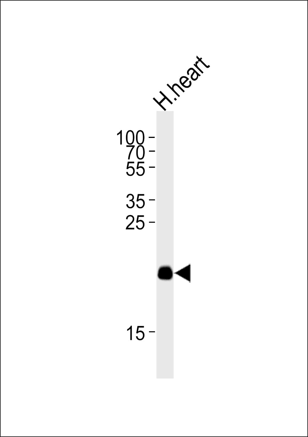 ORMDL2 Antibody (aa53-81)