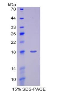 Human PTPRN / IA-2 Protein (Recombinant His)