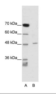 CACNB4 Antibody (aa361-410)