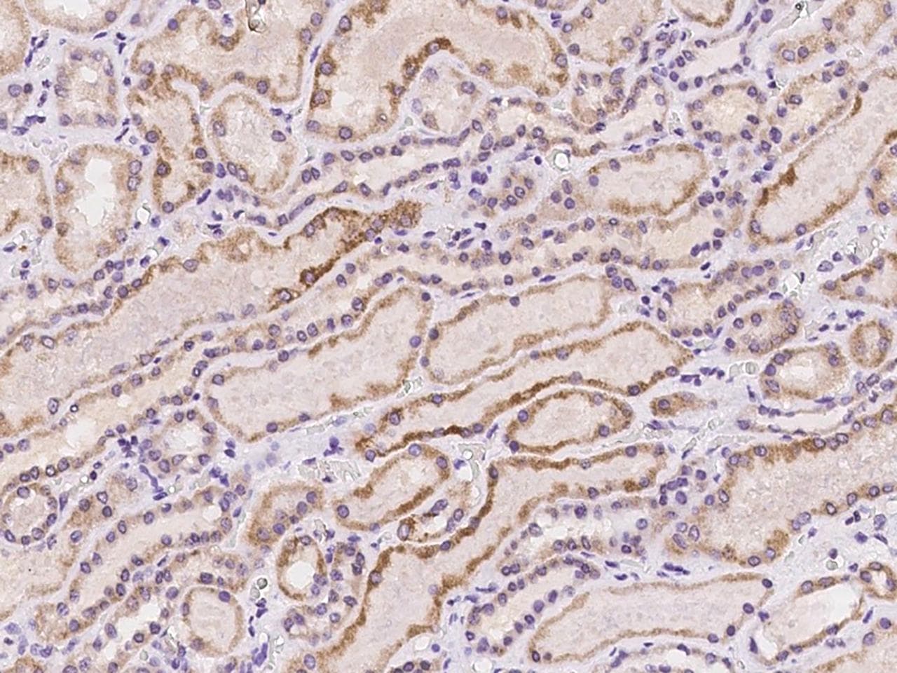 DDX26B Antibody