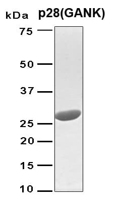 Human PSMD10 / Gankyrin Protein (Recombinant 6His, N-terminus)