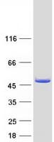 Human HMBS / PBGD Protein (Recombinant Myc-DDK (Flag))