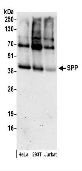 HM13 / IMP-1 / SPP Antibody (aa327-377)