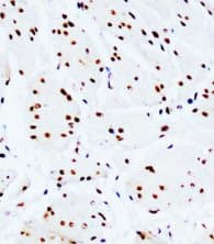 Monoclonal Mouse anti-Human MYC / c-Myc Antibody (clone IMD-3, Magnetic beads, aa408-439)