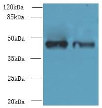 DBF4B / DRF1 Antibody